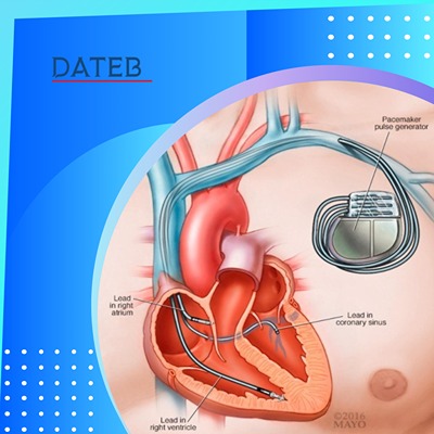 دستگاه ضربان ساز قلب